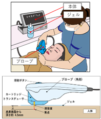 画像:ネオジム磁石製のマグネットセット